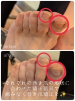 画像投稿者: Dr.ネイル爪革命 上川管内