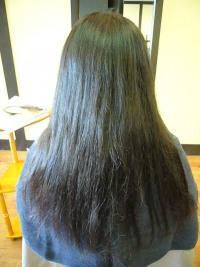 初矯正！ビフォー&アフター