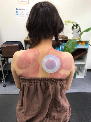 ファンクショナル・カッピング(ＦＣ)コース