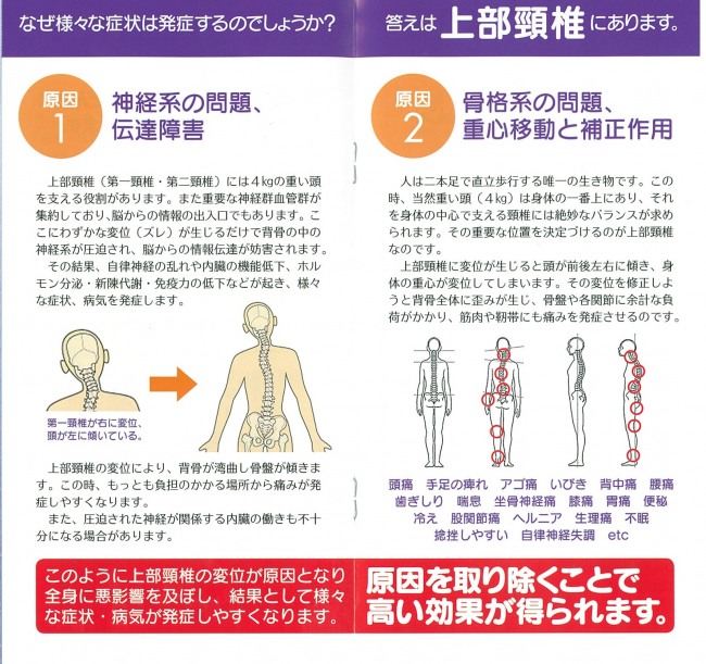 様々な症状の原因は「上部頚椎」にあります