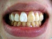 ホワイトコート